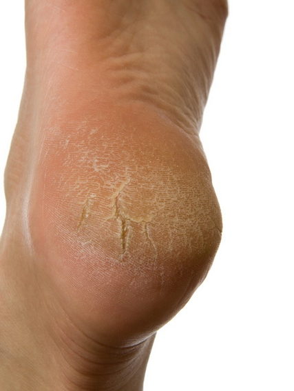 Foot Care – Podiatry on Plenty